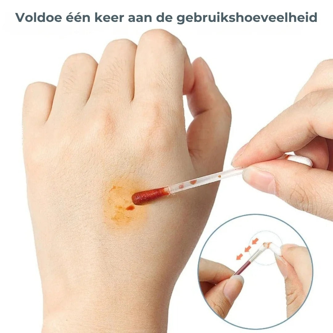 Jodium wattenstaafjes set van 50