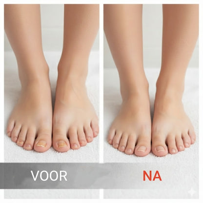 Nagelherstellende essence voor beschadigde nagels