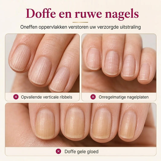 Nagelribbelvuller met natuurlijke glans