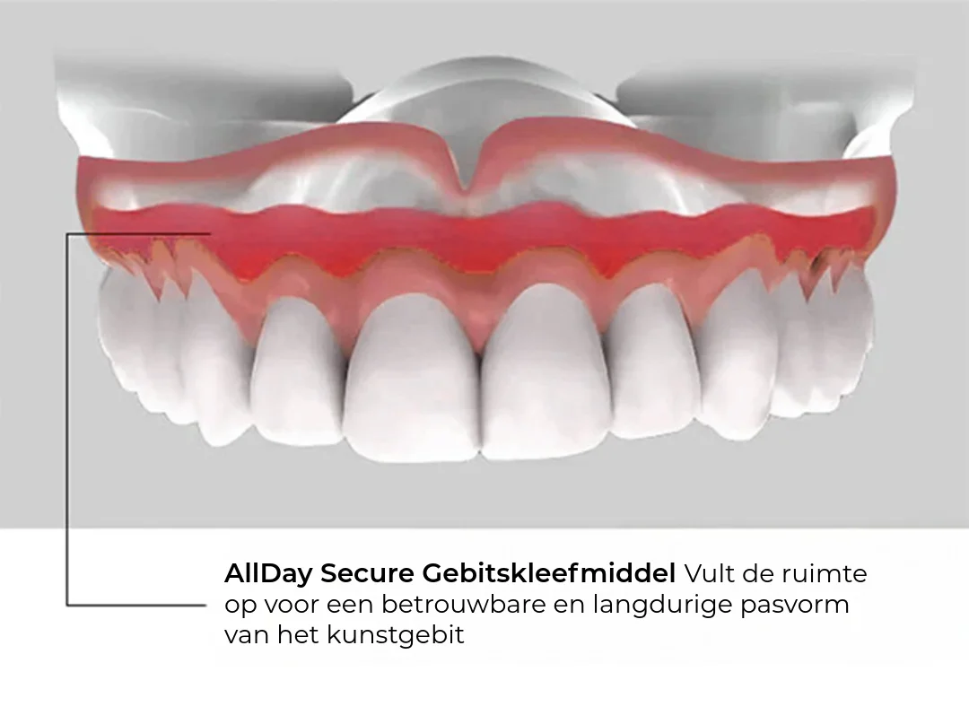 Allday Secure Sterke Kunstgebitlijm