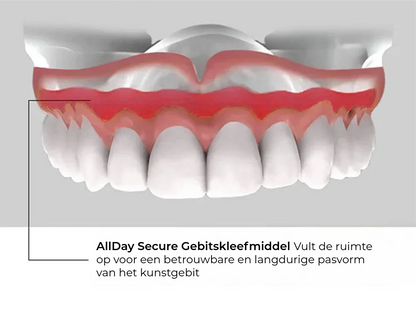 Allday Secure Sterke Kunstgebitlijm