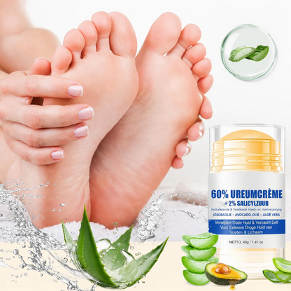 Hydraterende Voetcrème tegen Kloven